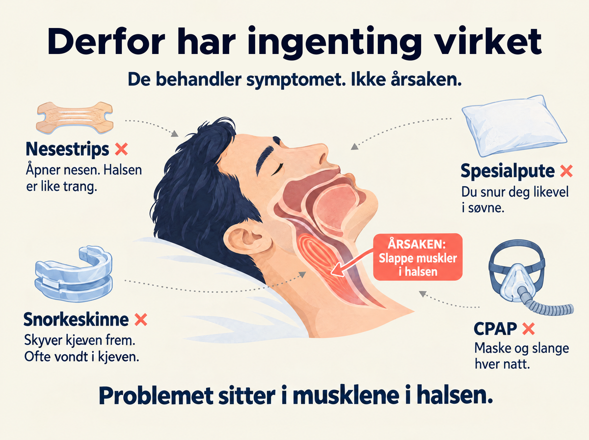 Derfor har ingenting virket: nesestrips, snorkeskinne, spesialpute og CPAP behandler symptomet, ikke musklene i halsen